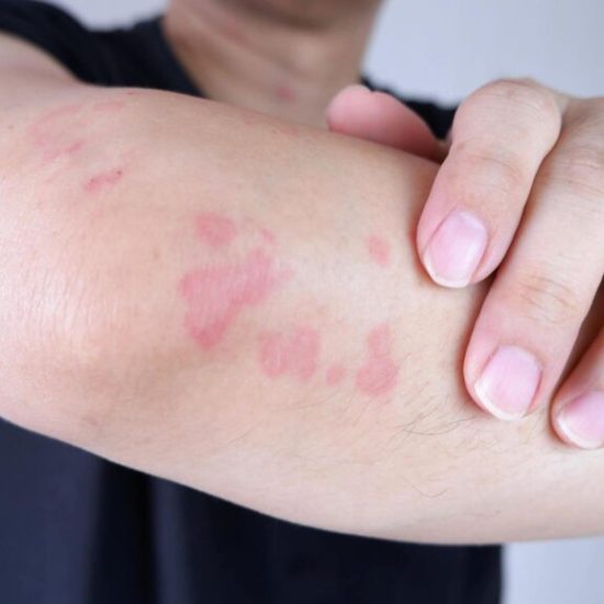 Skin Infection & Rash Care