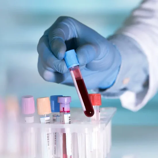 Lab